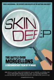 دانلود فیلم Skin Deep: The Battle Over Morgellons سال 2019 - تا عمق پوست: نبرد بر سر مورجلون