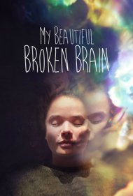 دانلود فیلم My Beautiful Broken Brain سال 2014 - مغز زیبای آسیبدیده من