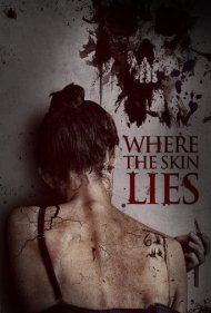 دانلود فیلم Where the Skin Lies سال 2017 - جایی که پوست دروغ میگوید