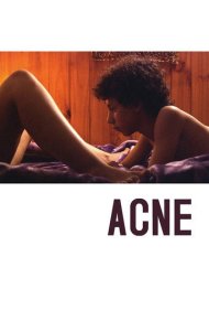 دانلود فیلم Acne سال 2008 - آکنه