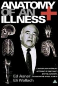 دانلود فیلم Anatomy of an Illness سال 1984 - کالبدشکافی یک بیماری